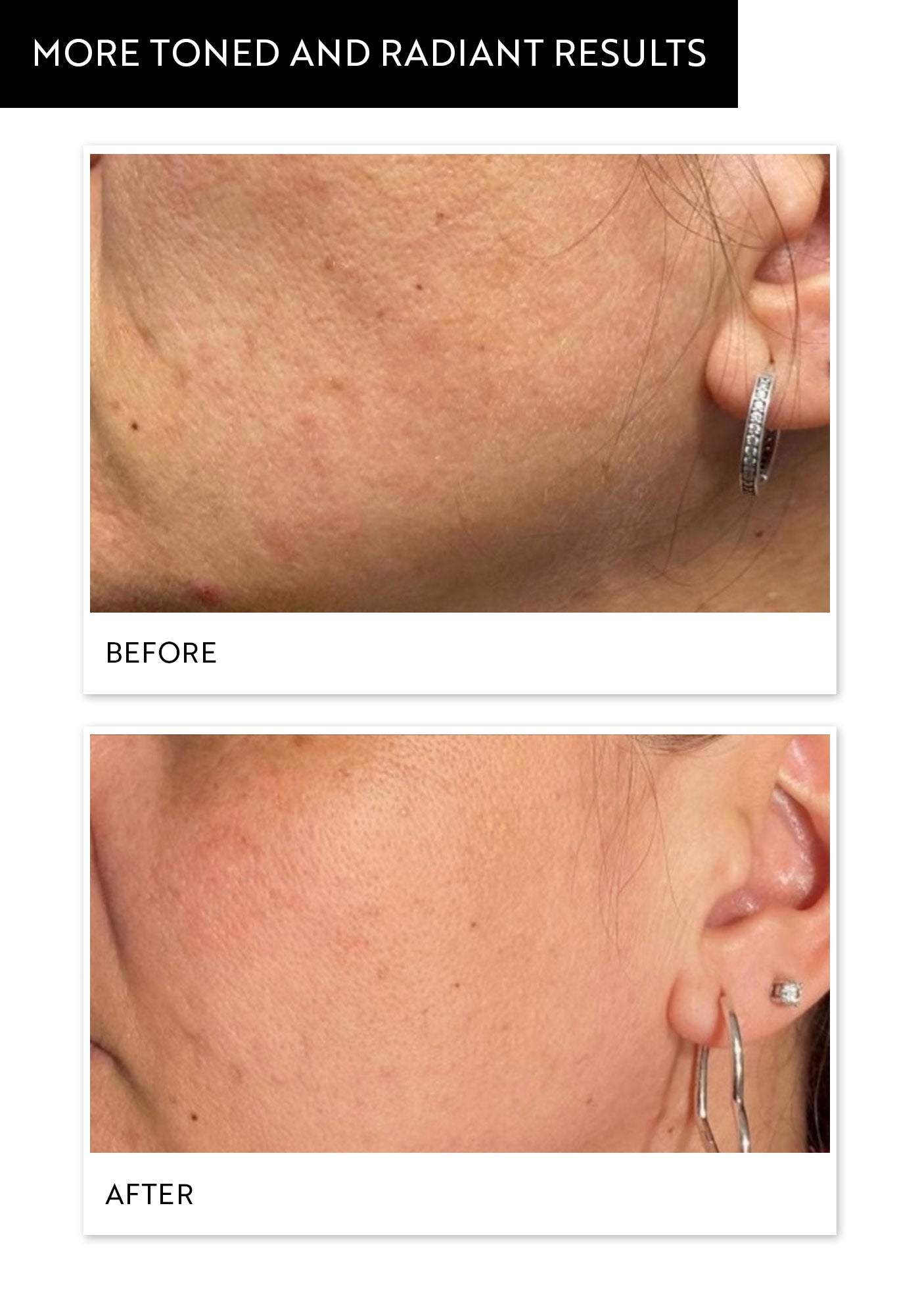 hydra-gel-mask-before-after