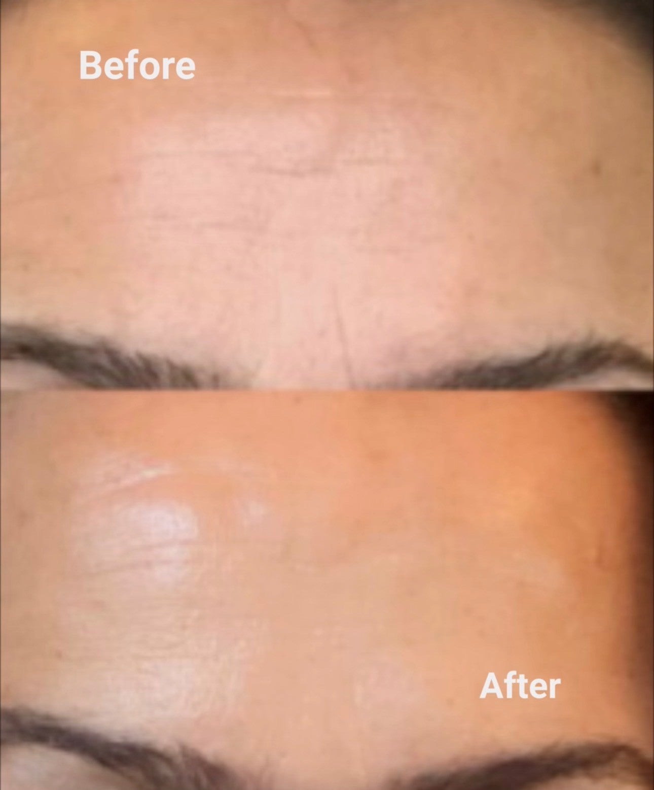 Pro Age + Super Face Moisturiser - Advanced Botanical Firming & Multi-Depth Hydration- Read More Below