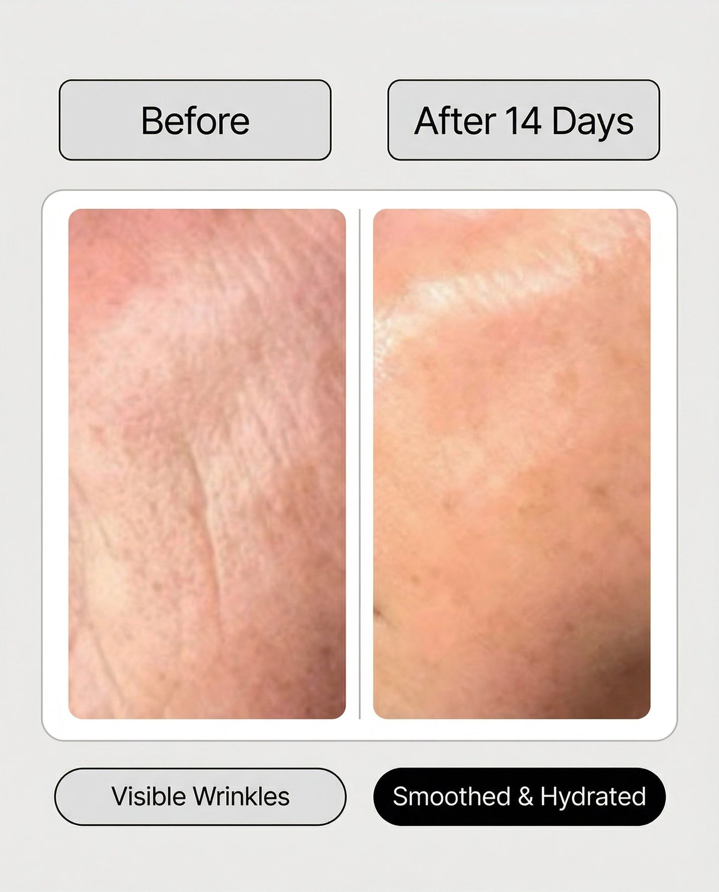 Pro Age + Skincare  Advanced formulas that support collagen, improve elasticity, and rejuvenate mature skin with real, noticeable results- Read More Below
