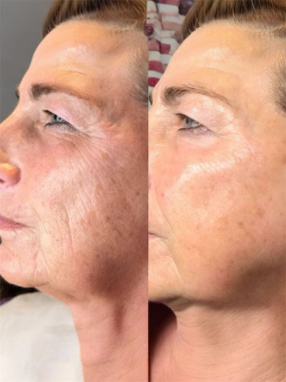 Pro Age + Super Face Moisturiser - Advanced Botanical Firming & Multi-Depth Hydration- Read More Below