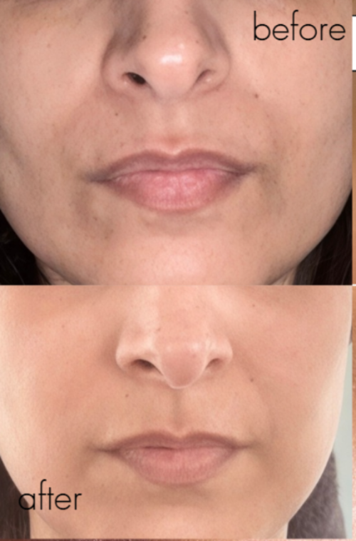 Pro Age + Skincare  Advanced formulas that support collagen, improve elasticity, and rejuvenate mature skin with real, noticeable results- Read More Below