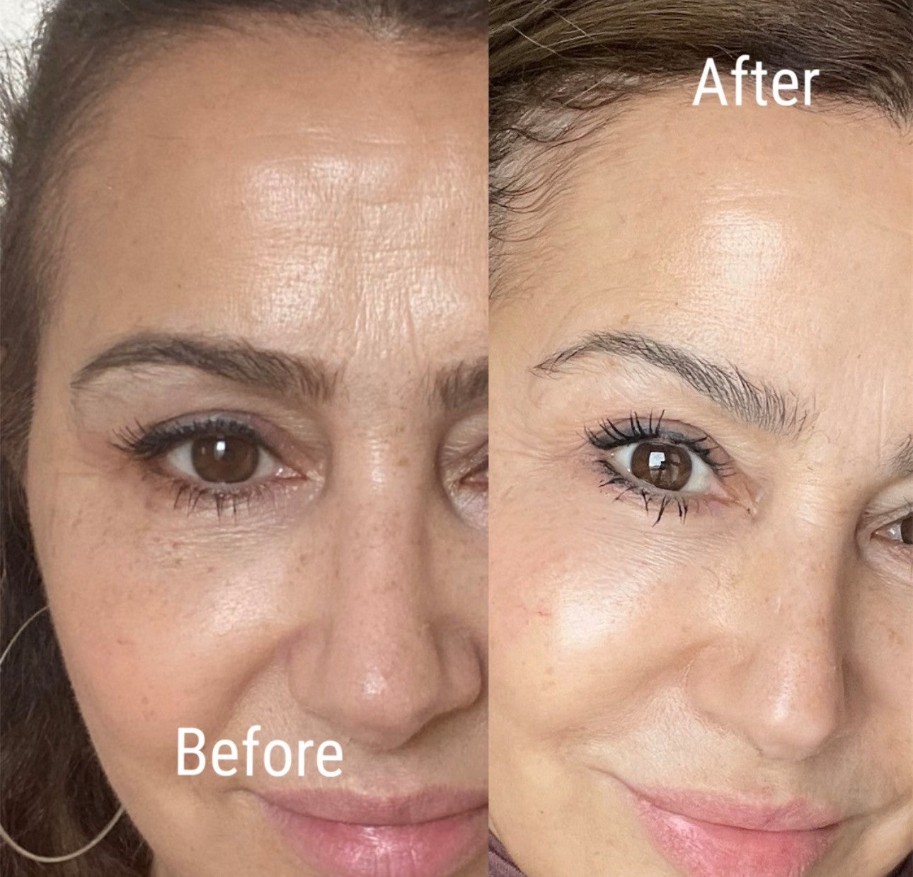 The Skin Renewal Collection