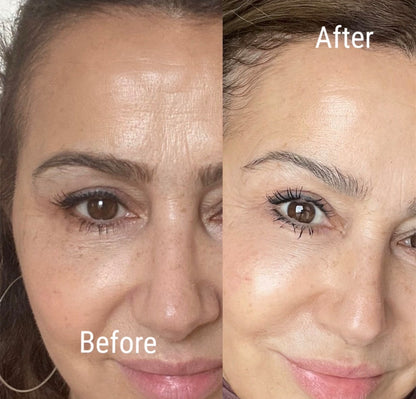The Skin Renewal Collection