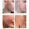 Collagen Boosting Moisturiser before and after use